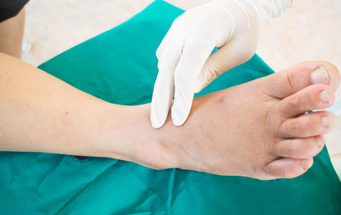 Here’s what you need to know about neuropathy symptoms and more